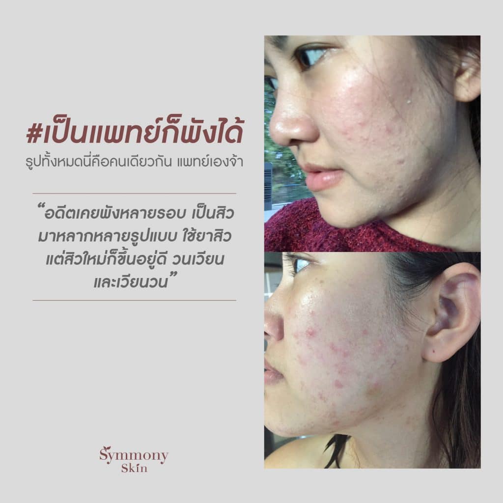 Relief Gentle Essence — เอสเซนส์ฟื้นฟูผิวจาก Demo Store